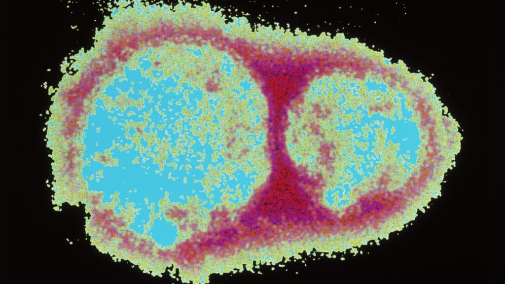 Opinion: I’m fighting misinformation online. False hantavirus claims follow a now-familiar playbook - hantavirus update